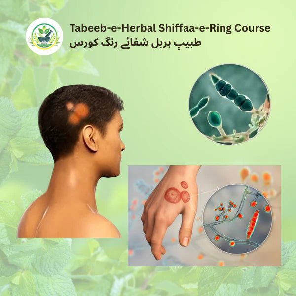 Tabeeb-e-Herbal Shiffaa-e-Ring Course image 0